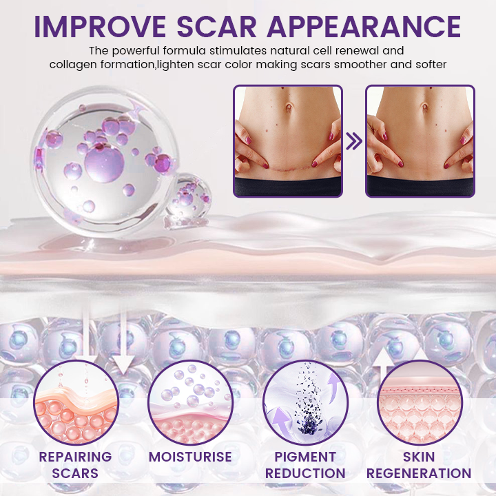 Jaxvolt® ReGenScar Stem Cell Scar Gel