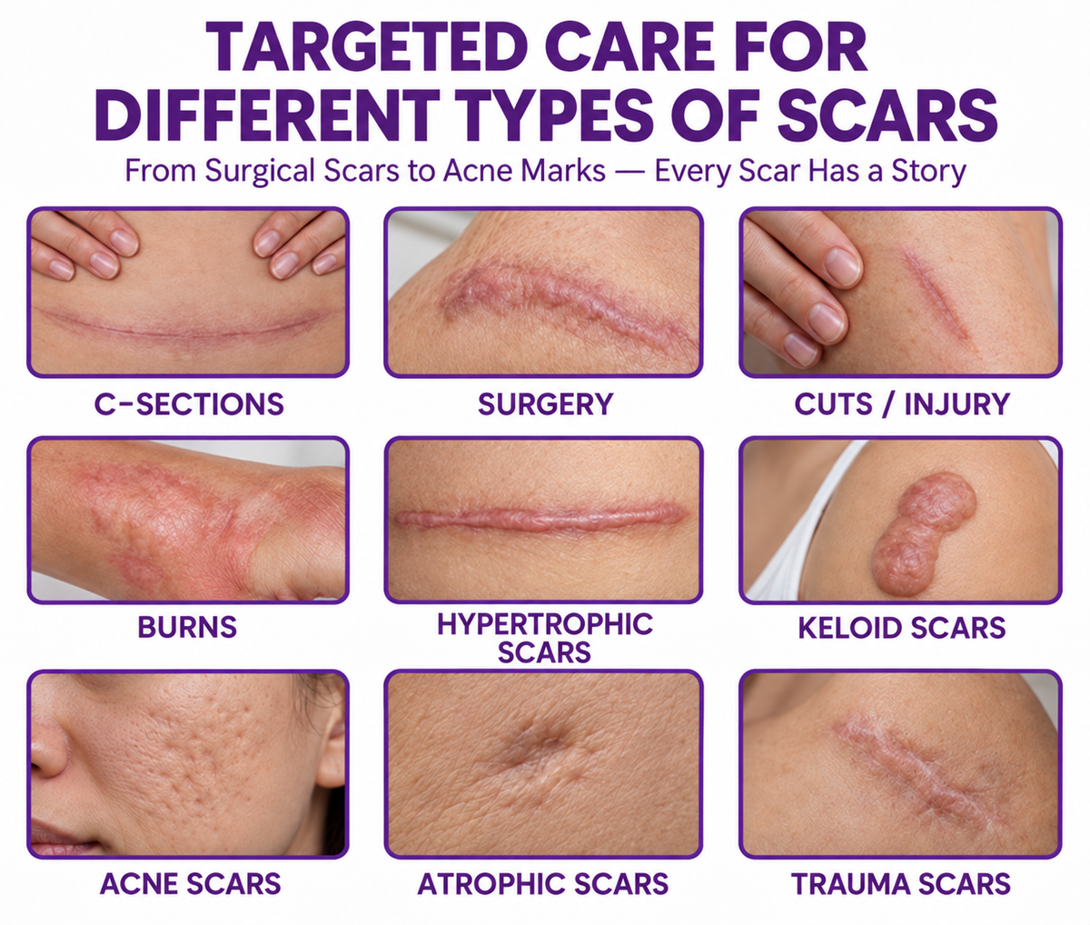 Jaxvolt® ReGenScar Stem Cell Scar Gel