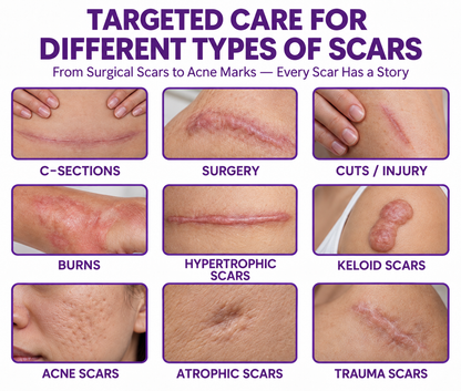 Jaxvolt® ReGenScar Stem Cell Scar Gel
