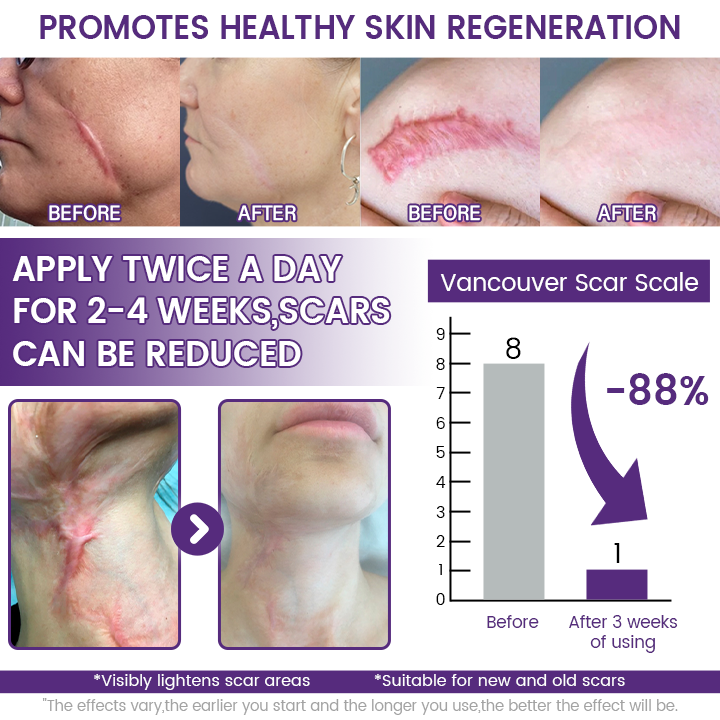Jaxvolt® ReGenScar Stem Cell Scar Gel