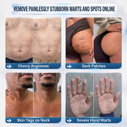 𝐍𝐞𝐱𝐢𝐬𝐢𝐟𝐲® 💧𝟕-𝐃𝐚𝐲 𝐒𝐤𝐢𝐧 𝐓𝐚𝐠 & 𝐒𝐩𝐨𝐭 𝐄𝐫𝐚𝐬𝐞𝐫 𝐂𝐫𝐞𝐚𝐦