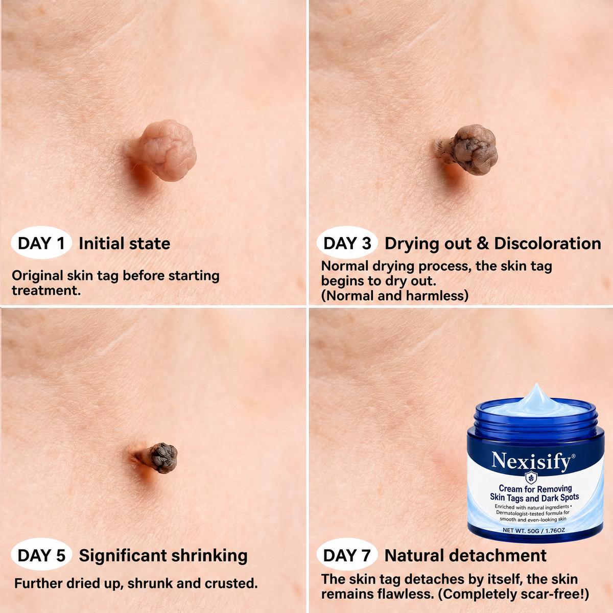 𝐍𝐞𝐱𝐢𝐬𝐢𝐟𝐲® 💧𝟕-𝐃𝐚𝐲 𝐒𝐤𝐢𝐧 𝐓𝐚𝐠 & 𝐒𝐩𝐨𝐭 𝐄𝐫𝐚𝐬𝐞𝐫 𝐂𝐫𝐞𝐚𝐦