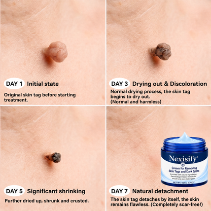 𝐍𝐞𝐱𝐢𝐬𝐢𝐟𝐲® 💧𝟕-𝐃𝐚𝐲 𝐒𝐤𝐢𝐧 𝐓𝐚𝐠 & 𝐒𝐩𝐨𝐭 𝐄𝐫𝐚𝐬𝐞𝐫 𝐂𝐫𝐞𝐚𝐦